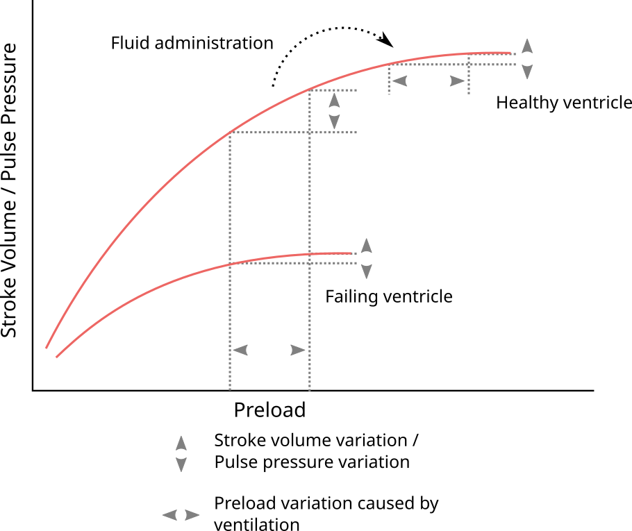 Illustration of how PPV reflects the current slope on the Frank-Starling curve, and, therefore, is an indicator of fluid responsiveness.